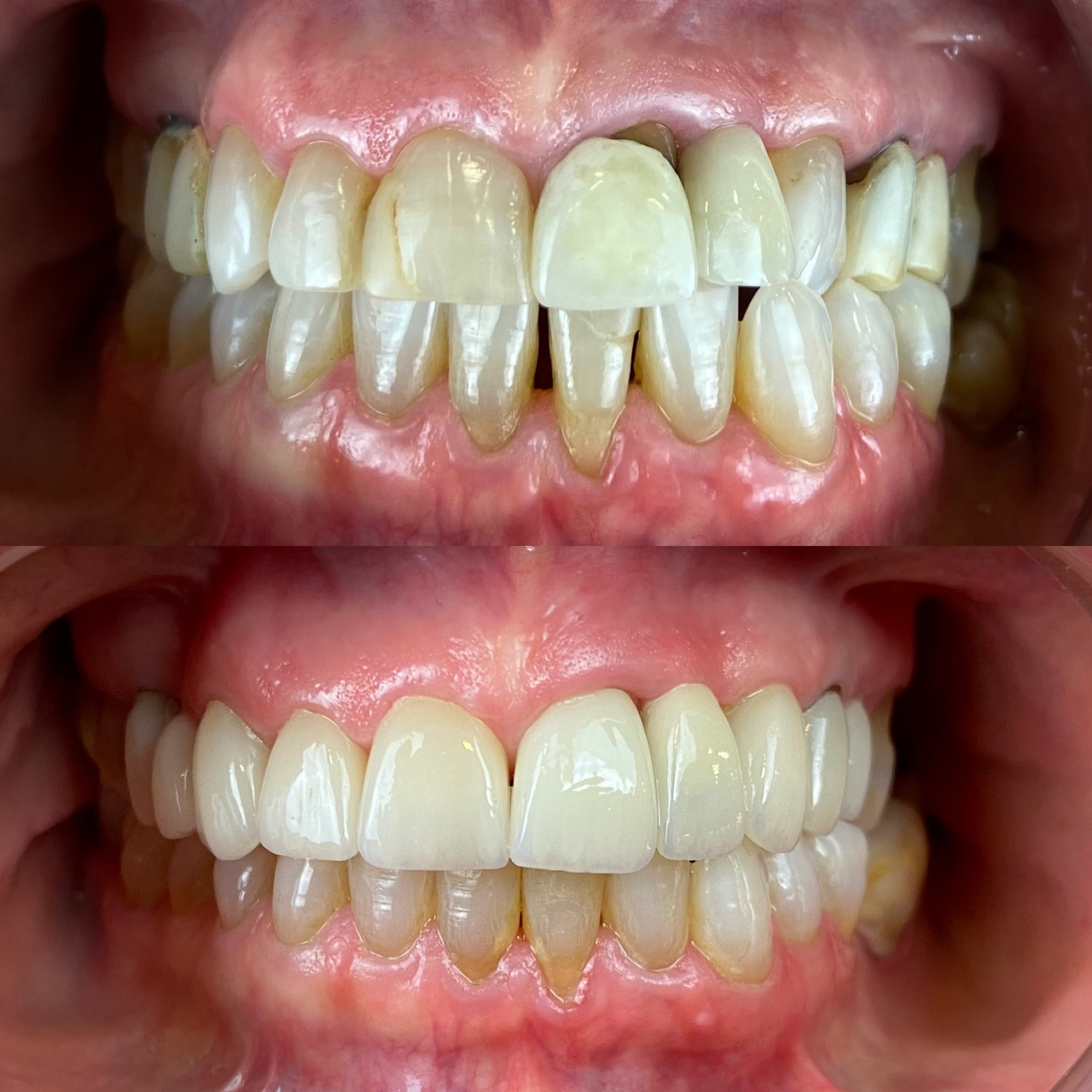 Detalhe de resultado odontológico — caso 5