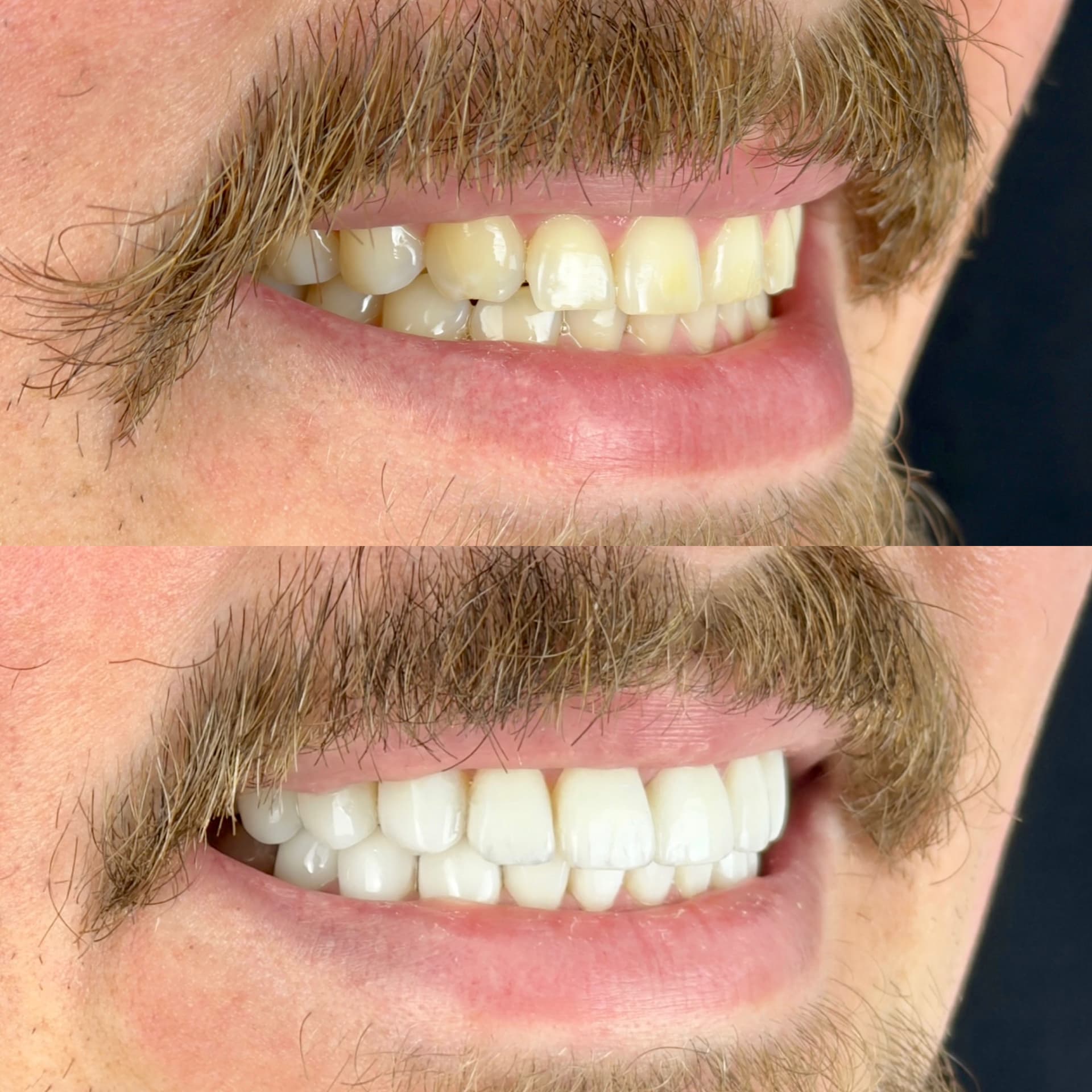 Detalhe de resultado odontológico — caso 3